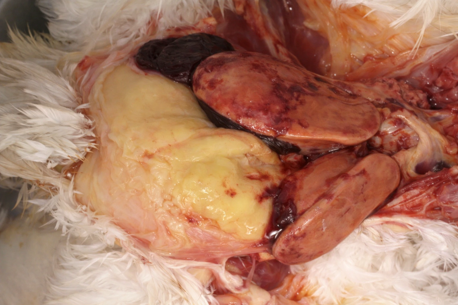 fettlever vid obduktion